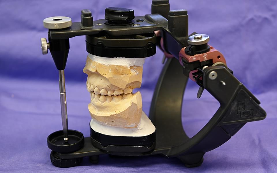 安全に長く使える入れ歯